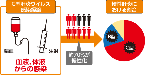 C型肝炎ウイルス