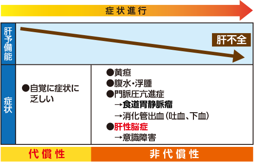 末期 肝硬変 アルコール 症状 性