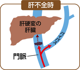 ダニの咬傷と勃起不全