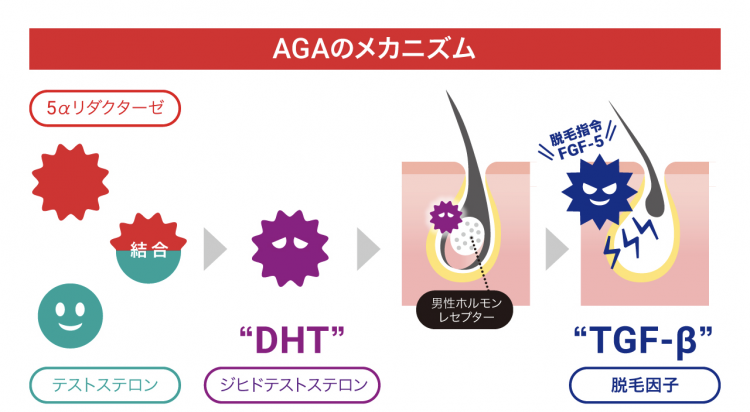 AGAのメカニズム