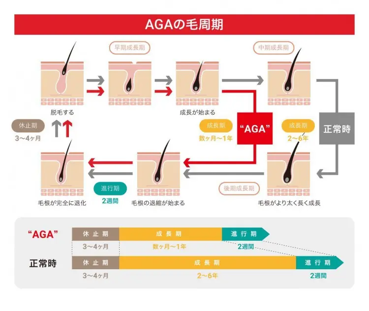AGAの毛周期