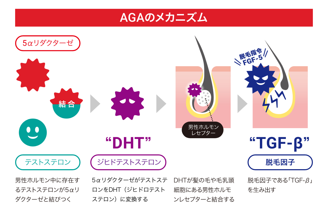 AGAのメカニズム