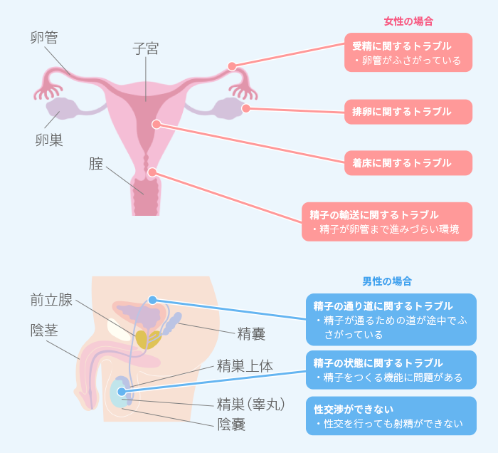 一般的な不妊の原因は？