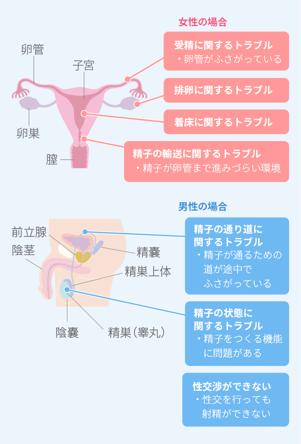 一般的な不妊の原因は？