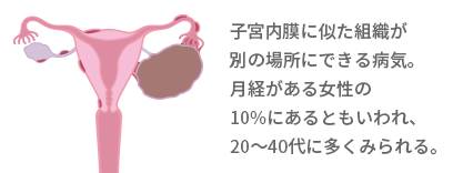 早めに気づいて 女性に多い病気と症状 知っておきたい女性のカラダと健康のこと 女性のための健康ラボ Mint