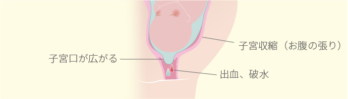 子宮 降り て くる